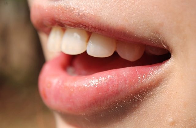 Maintain Healthy Teeth